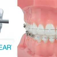 стоматология и косметология зубок на преображенской площади изображение 7